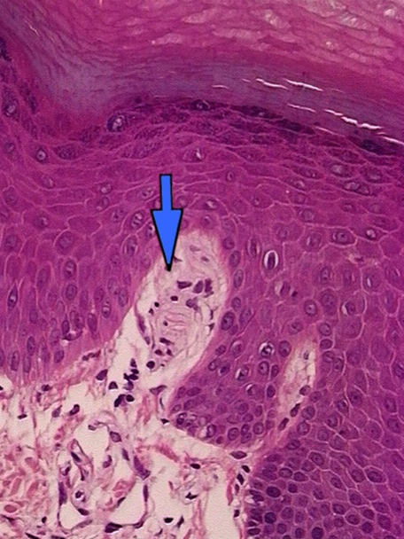 该层还有许多血管,淋巴管和神经(末梢),如环层小体(图11