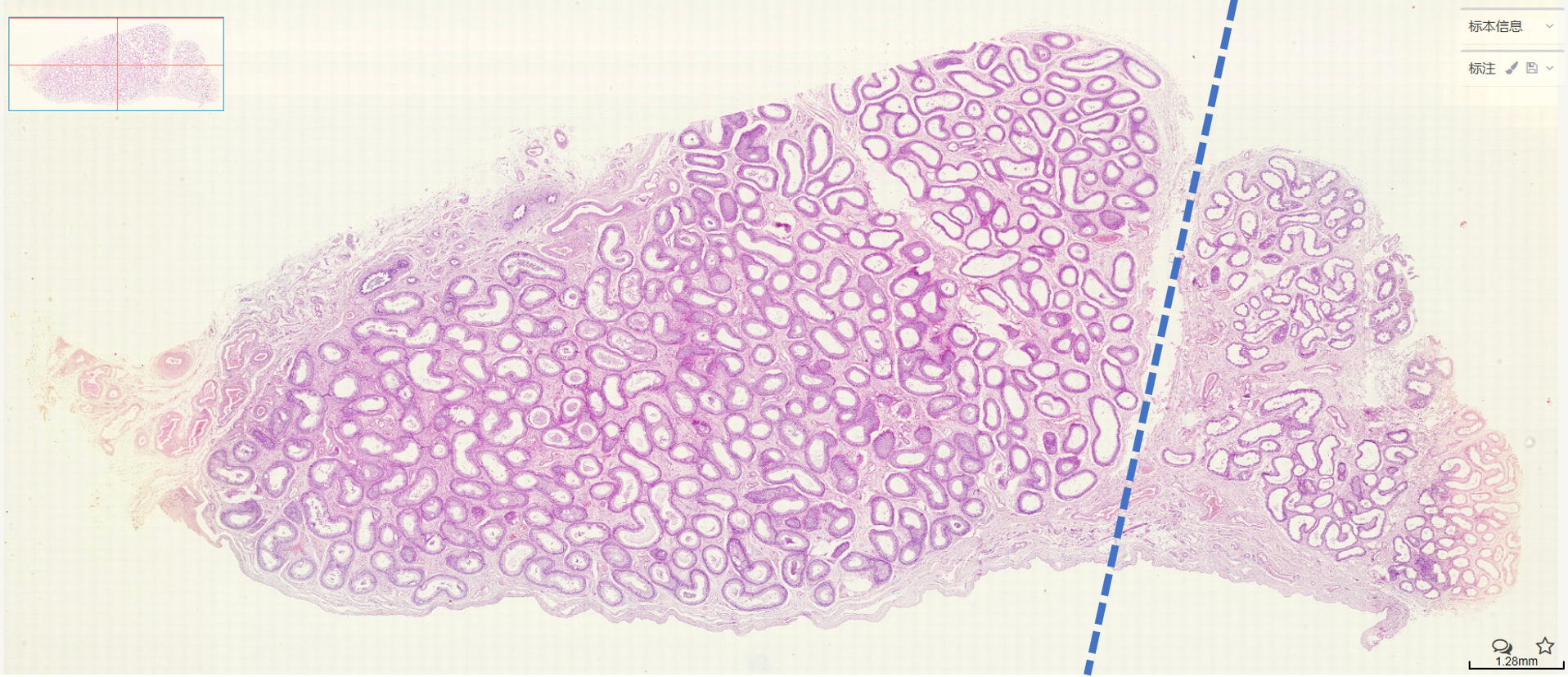 附睾 Epididymis