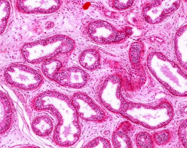 为与睾丸网相接的10余条弯曲的小管,构成附睾头的大部,其远端与附睾