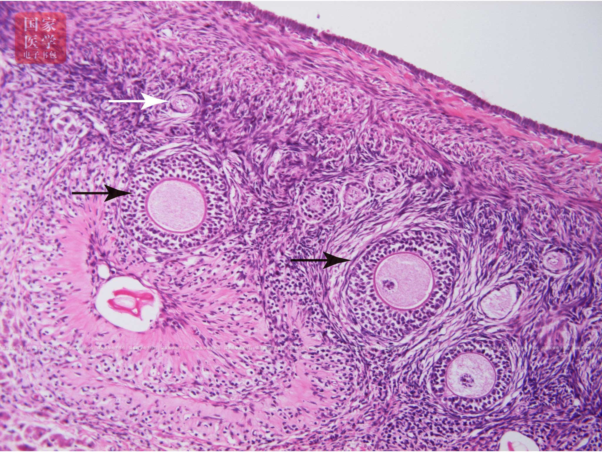 由中央一个初级卵母细胞(primaryoocyte)和周围单层扁平的卵泡细胞