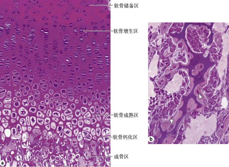 (b)图,过渡性骨小梁显微照片:中间紫色部分为钙化的软骨基质,周围染色