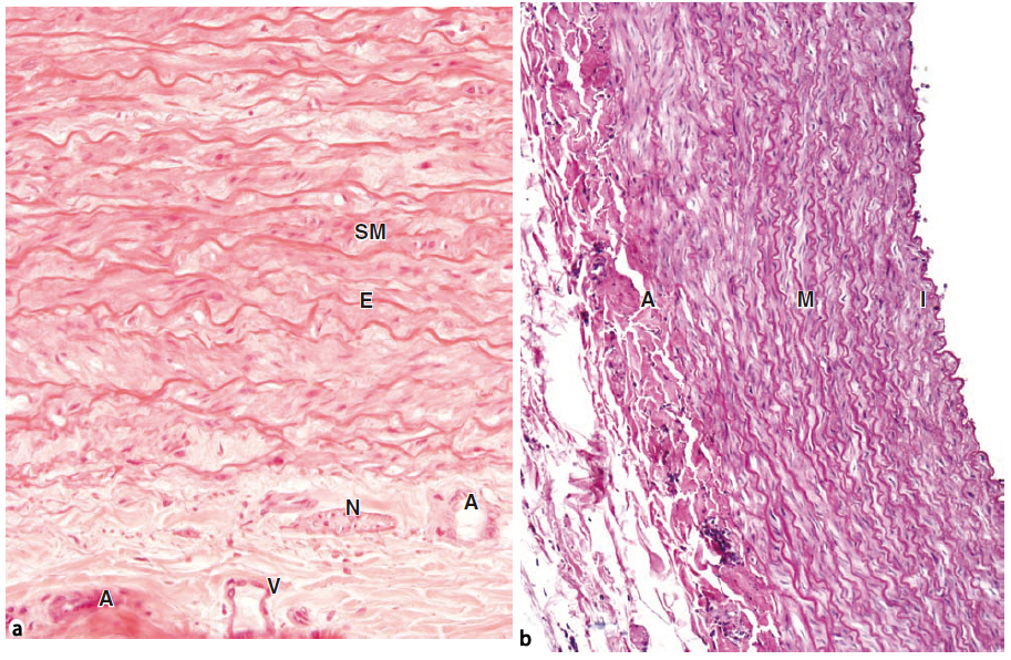 内皮下层为疏松结缔组织,有内弹性膜