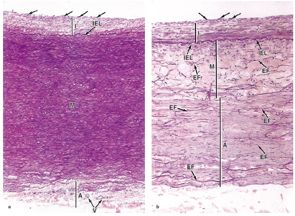 外膜:疏松结缔组织;有营养血管,分支进入中膜很厚,40 ~ 70层弹性膜
