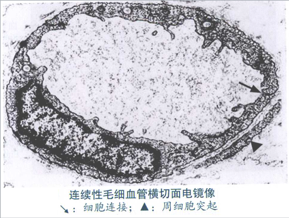 毛细血管显微镜图片图片